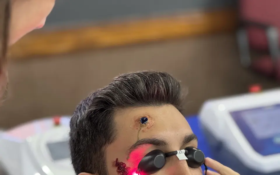 Aplicação supervisionada de laser terapêutico com proteção ocular
